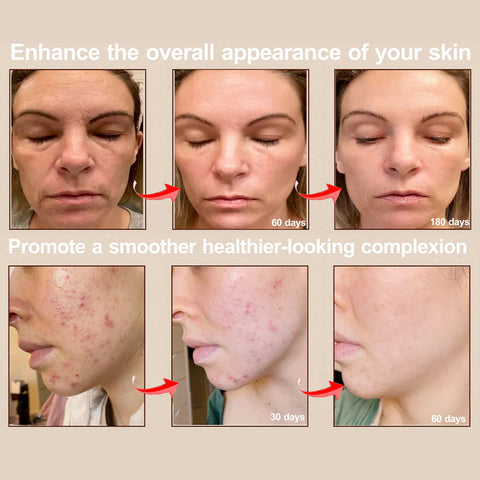 LED Face Mask Light Therapy Pro – Advanced Skin Rejuvenation Device